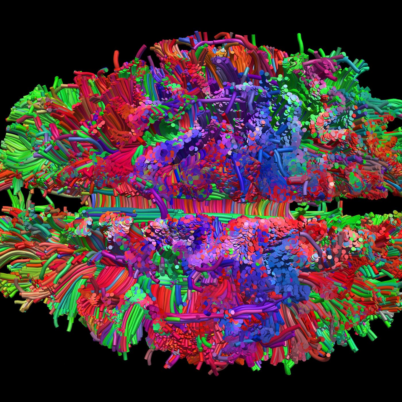 Colourful scan of the brain seen from above on a black background